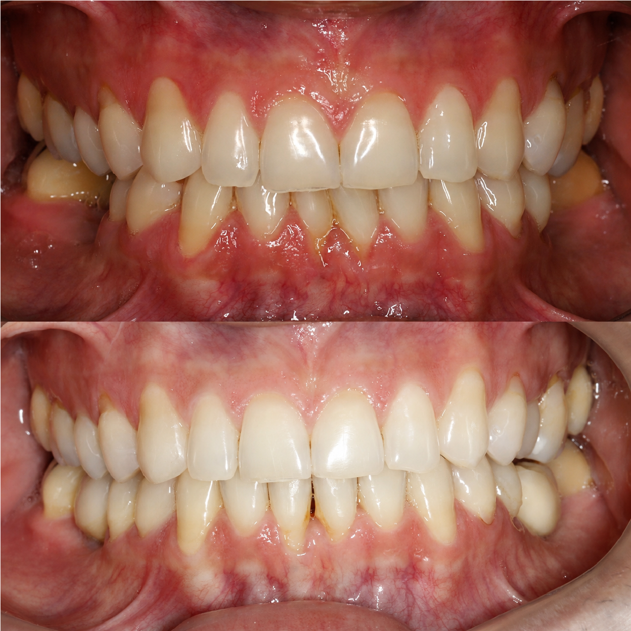 Caso 1 Banner Sorrisos Incríveis