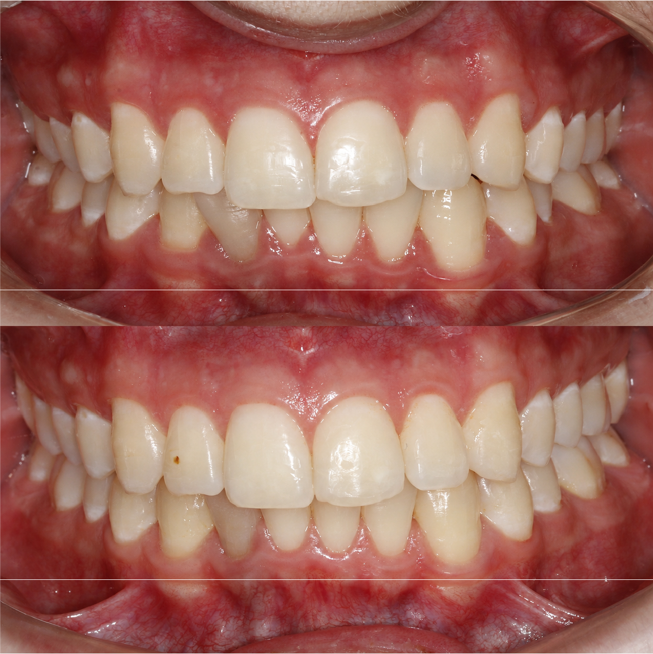 Caso 2 Banner Sorrisos Incríveis