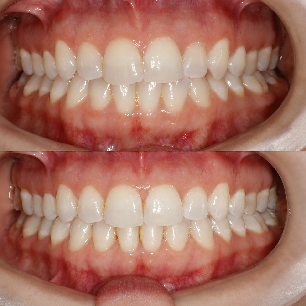Caso 3 Banner Sorrisos Incríveis