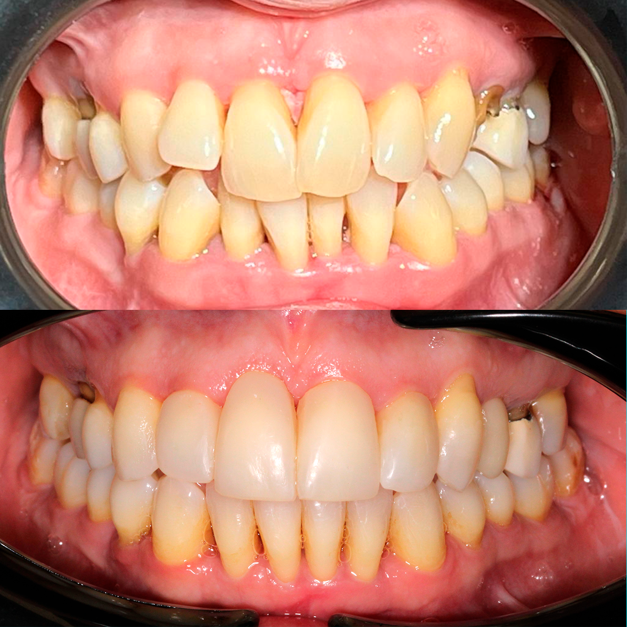 Caso 1 Banner Sorrisos Incríveis