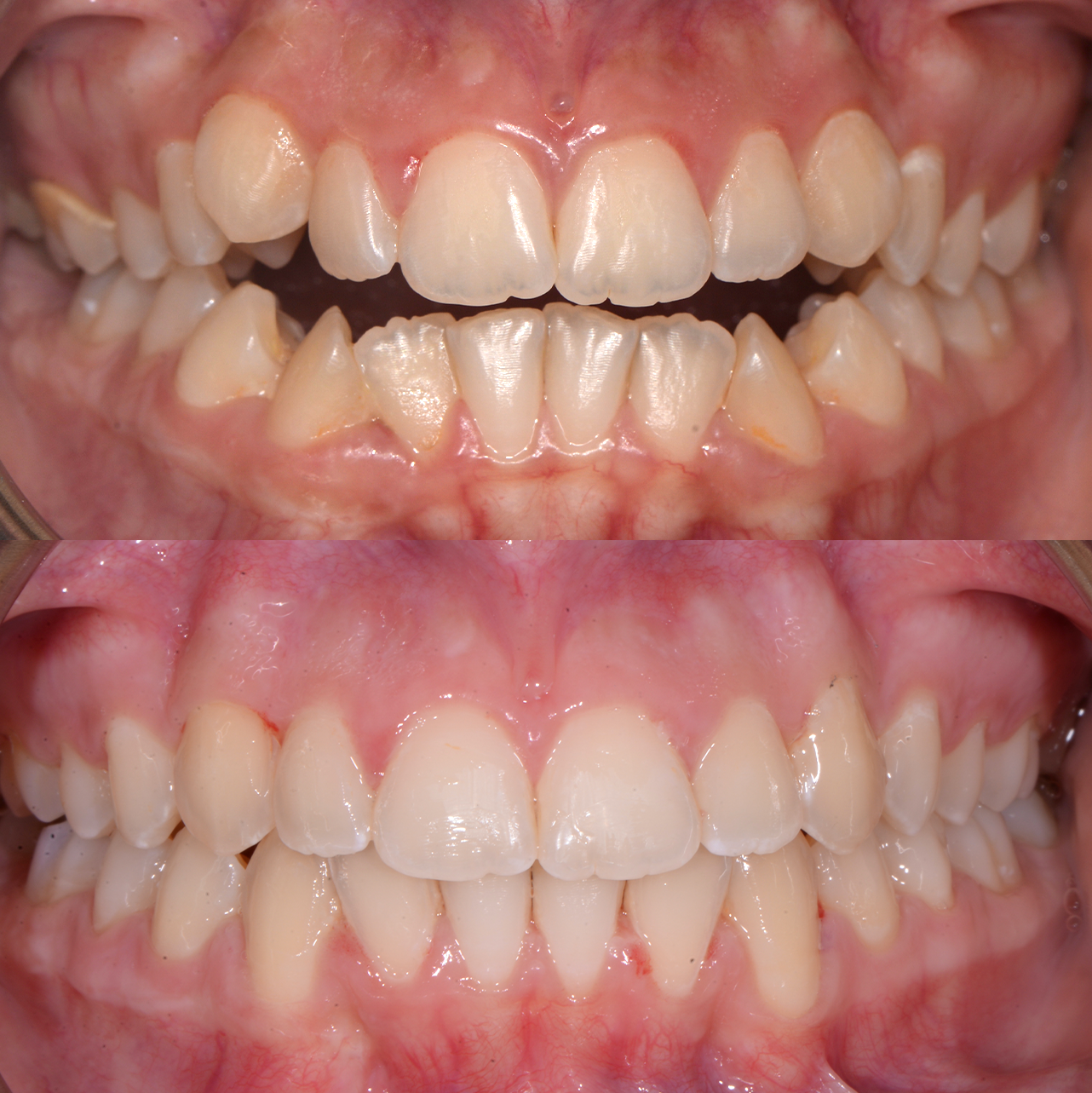 Caso 2 Banner Sorrisos Incríveis