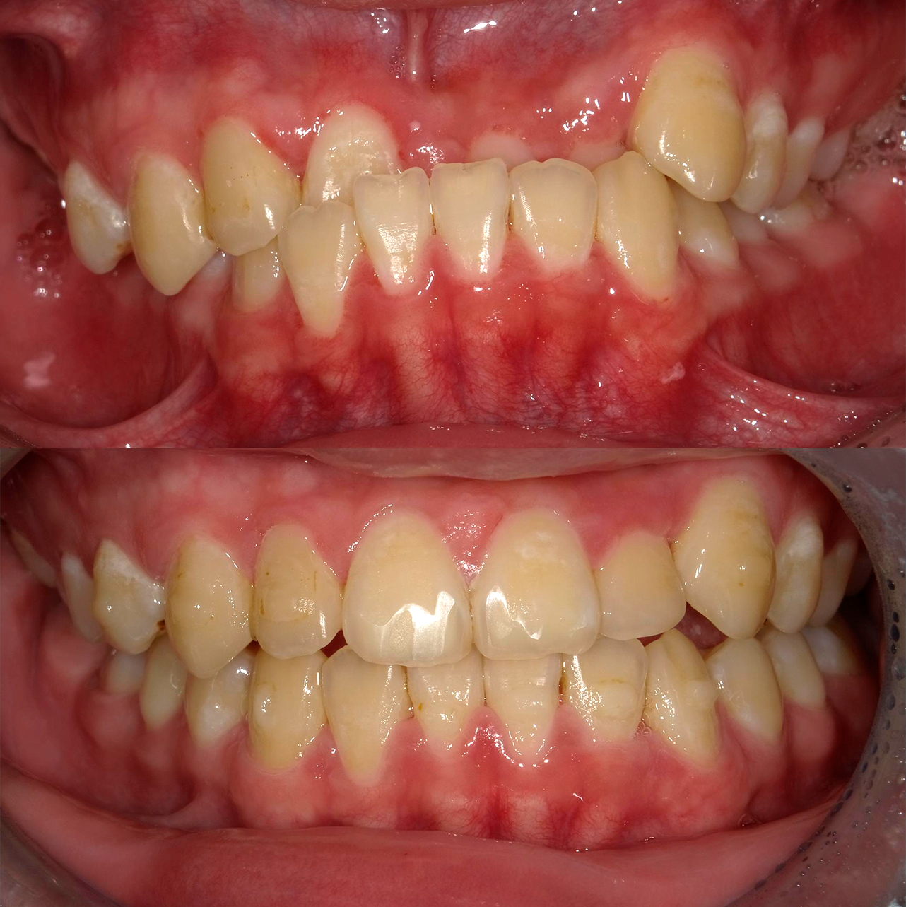 Caso 3 Banner Sorrisos Incríveis