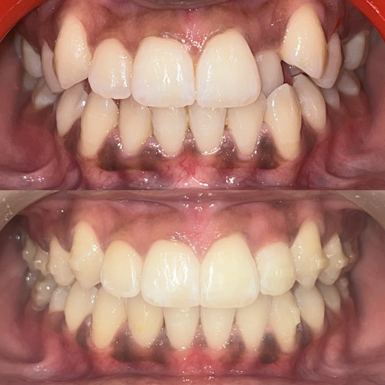 Caso 4 Banner Sorrisos Incríveis