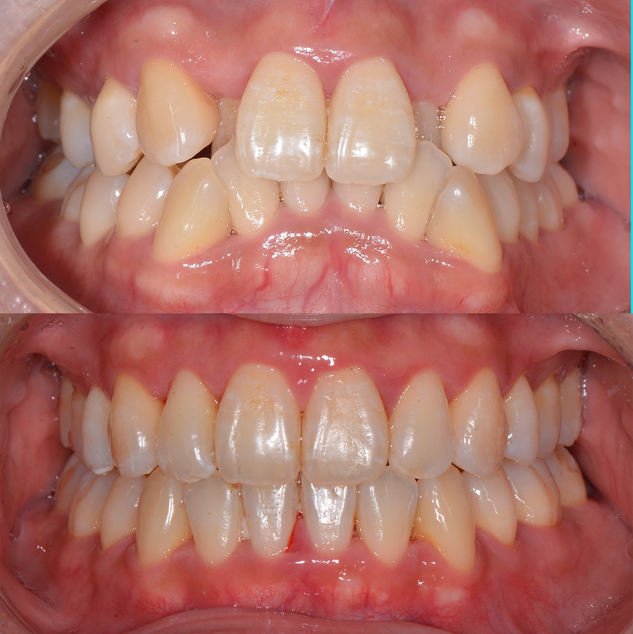 Caso 5 Banner Sorrisos Incríveis
